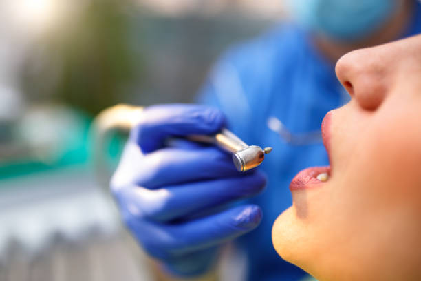 Dental Bonding in Toulon, IL